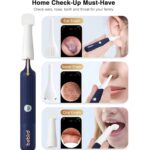 Bebird Smart Ear Cleaner - Image 6